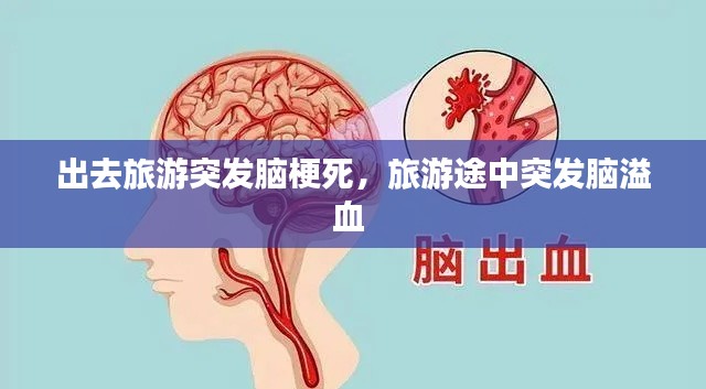 出去旅游突发脑梗死,旅游途中突发脑溢血