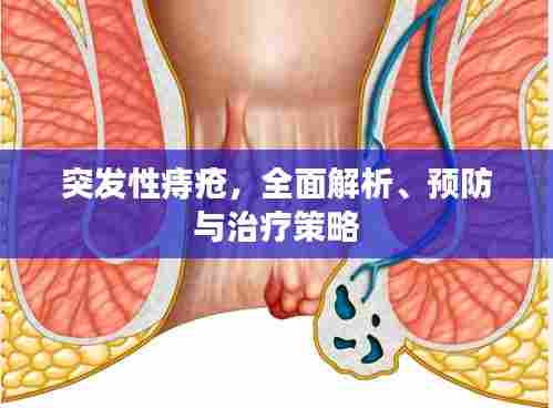 突发性痔疮，全面解析、预防与治疗策略